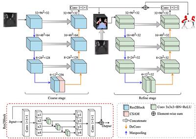 Automated Segmentation of Trigeminal Nerve and Cerebrovasculature in MR-Angiography Images by Deep Learning